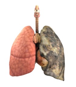 A set of lungs, before and after a lifetime of smoking 